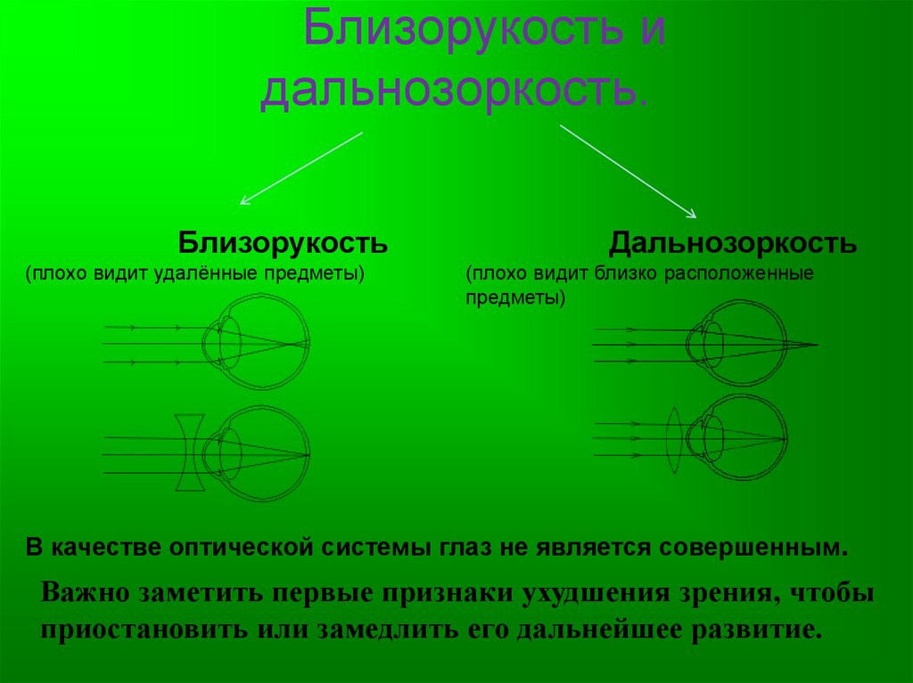Что такое близорукость и дальнозоркость простыми словами, отличия болезней oculistic.ru что такое близорукость и дальнозоркость простыми словами, отличия болезней