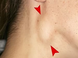 Возвращение туляремии…Что следующее?			     
        Возвращение туляремии…Что следующее?