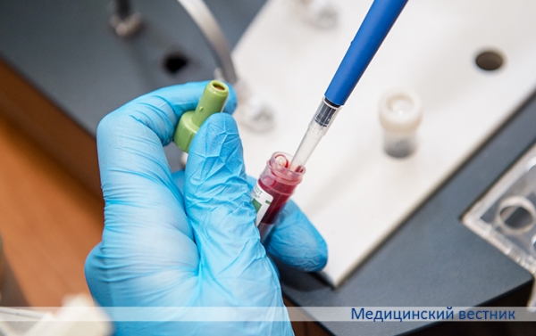 Почему не получается коагулограмма
Почему не получается коагулограмма