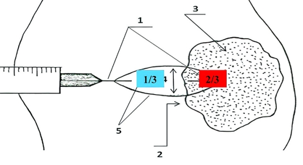 Патогистологическое сопровождение при диагностике заболеваний
Патогистологическое сопровождение при диагностике заболеваний