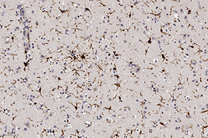 
        Патоморфологические изменения головного мозга при COVID-19			    