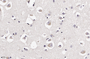 
        Патоморфологические изменения головного мозга при COVID-19			    