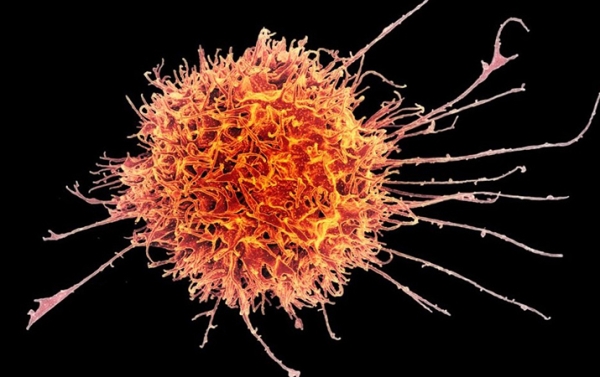 
        Соучастник тридемии: респираторно-синцитиальный вирус 			    