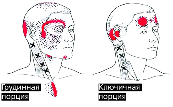 «Замороженные в мышцах чувства»: как связаны тревога, депрессия и боль?
«Замороженные в мышцах чувства»: как связаны тревога, депрессия и боль?