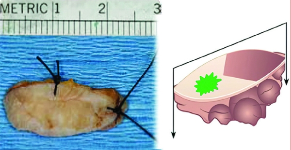 Патогистологическое сопровождение при диагностике заболеваний
Патогистологическое сопровождение при диагностике заболеваний