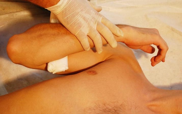 
        Первая помощь при острой кровопотере и травматическом шоке			    