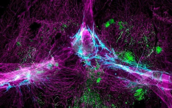 
        Ученые обнаружили,  что мозг не особая закрытая зона			    