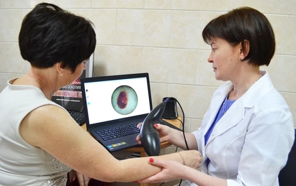 Ежегодно в Витебской области выявляется более 100 случаев меланомы			     
        Ежегодно в Витебской области выявляется более 100 случаев меланомы