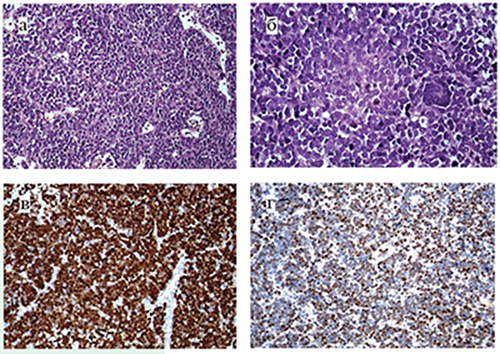 
        Cаркома опорно-двигательного аппарата у детей. Молекулярно-генетическая диагностика			    