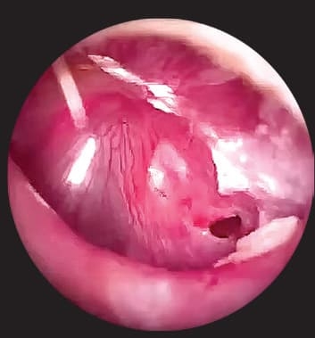 
        Ребенок с лор-патологией на приеме у ВОП и педиатра			    