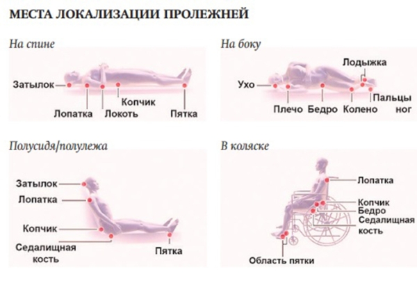 
        Принципы терапии и ухода за пациентами с поражениями кожи                     
