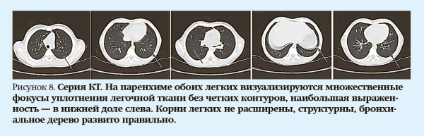 
        Кашель у детей: особенности дифференциальной диагностики                    