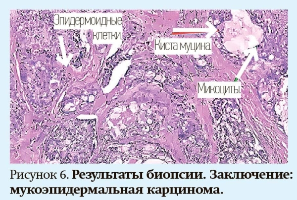 
        Кашель у детей: особенности дифференциальной диагностики                    