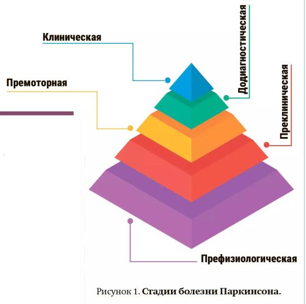 
        Ранние стадии болезни Паркинсона: диагностика и лечение + аудио                
        
        