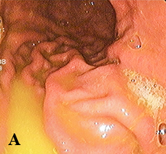 
        Халитоз: от симптома к диагнозу и терапии			    