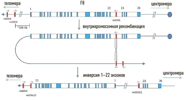 
        Гемофилия А в педиатрической практике: современные подходы к диагностике			    
