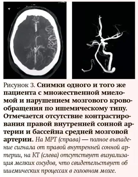 Лучевая диагностика при кровотечениях и тромбозах: плюсы и минусы разных методов                     
        Лучевая диагностика при кровотечениях и тромбозах: плюсы и минусы разных методов