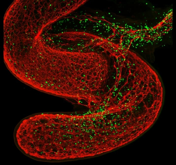 Как мозг управляет иммунными реакциями
Как мозг управляет иммунными реакциями