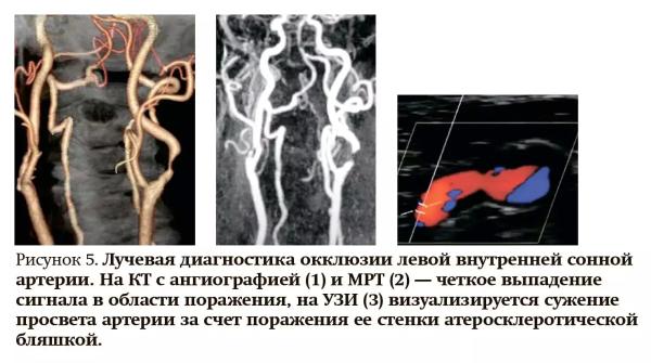 Лучевая диагностика при кровотечениях и тромбозах: плюсы и минусы разных методов                     
        Лучевая диагностика при кровотечениях и тромбозах: плюсы и минусы разных методов